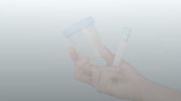 Pillar Content Employee Drug Screening Urinalysis Test